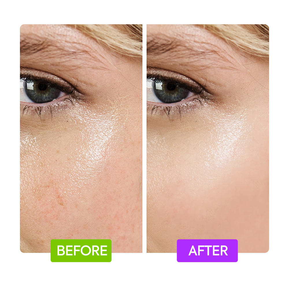 IYKYK 20% AHA + 10% NIACINAMIDE BOOSTER - 2 PACK - Image 5
