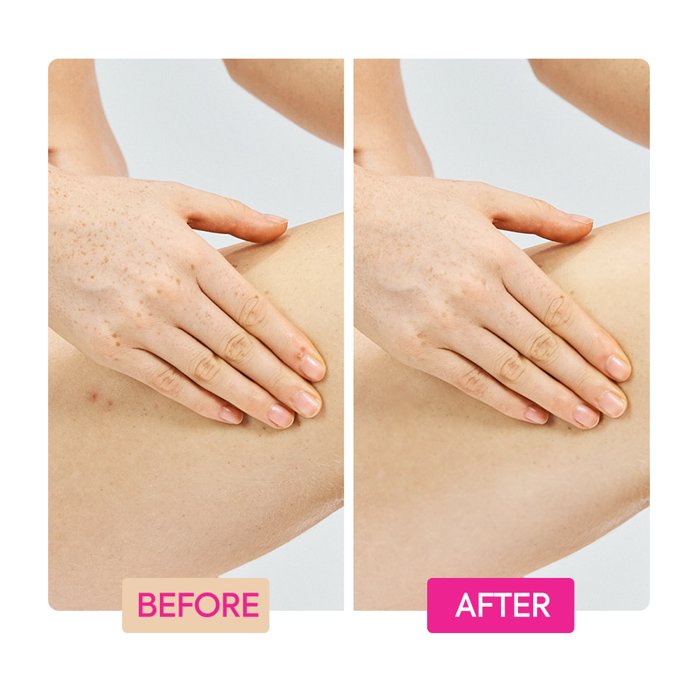 IYKYK GINGER EXTRACT + TRANEXAMIC ACID + RETINOL BODY TONING CREAM - 2 PACK - Image 8