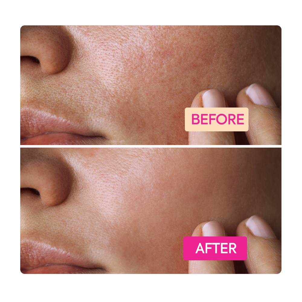 IYKYK NIACINAMIDE FACIAL CLEANSING BAR - 2 PACK - Image 5